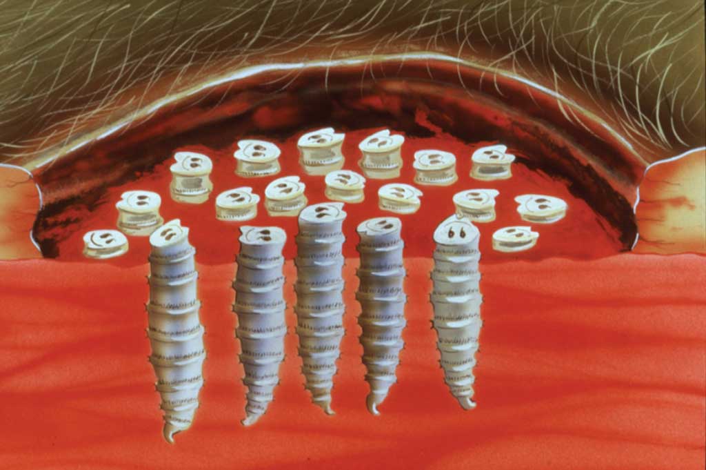 USDA slide of screwworm larve living in a wound.